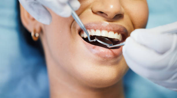 Best Urgent Care for Lost Fillings or Crowns in New Bedford, MA