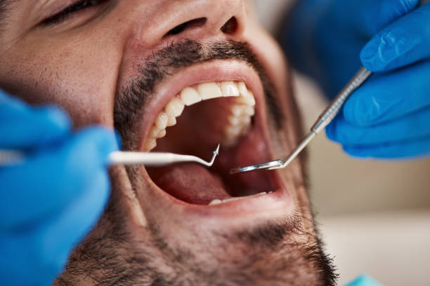 Best Emergency Tooth Extraction in New Bedford, MA